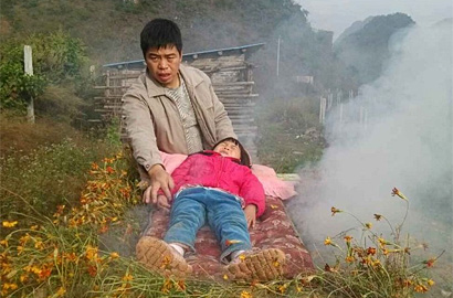父亲自学《本草纲目》火熏治疗患病女儿
